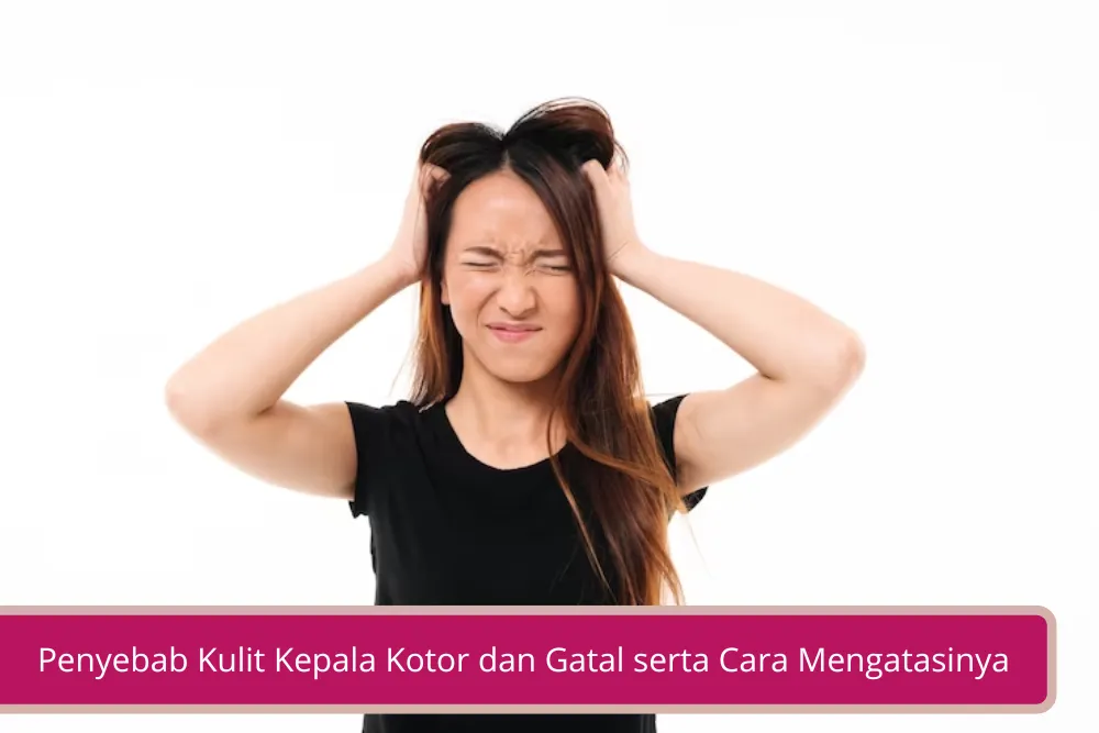 Gambar Penyebab Kulit Kepala Kotor dan Gatal Serta 3 Cara Mengatasinya Secara Mudah