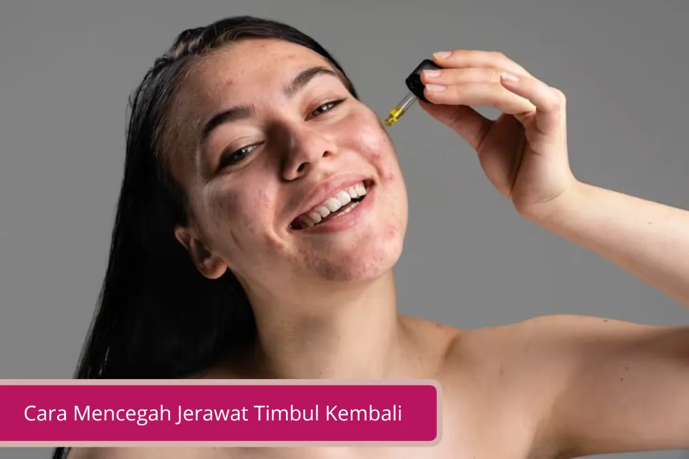 Gambar Cara Mencegah Jerawat Timbul Kembali