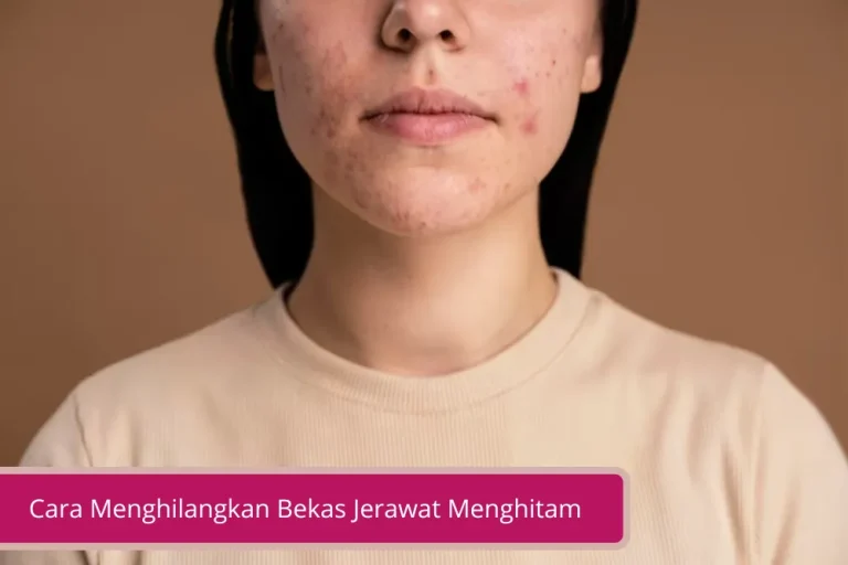 Gambar Cara Menghilangkan Bekas Jerawat Menghitam