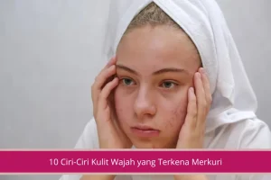 Gambar 10 Ciri Ciri Kulit Wajah yang Terkena Merkuri Dari Iritasi Sampai Perubahan Pigmen Kulit