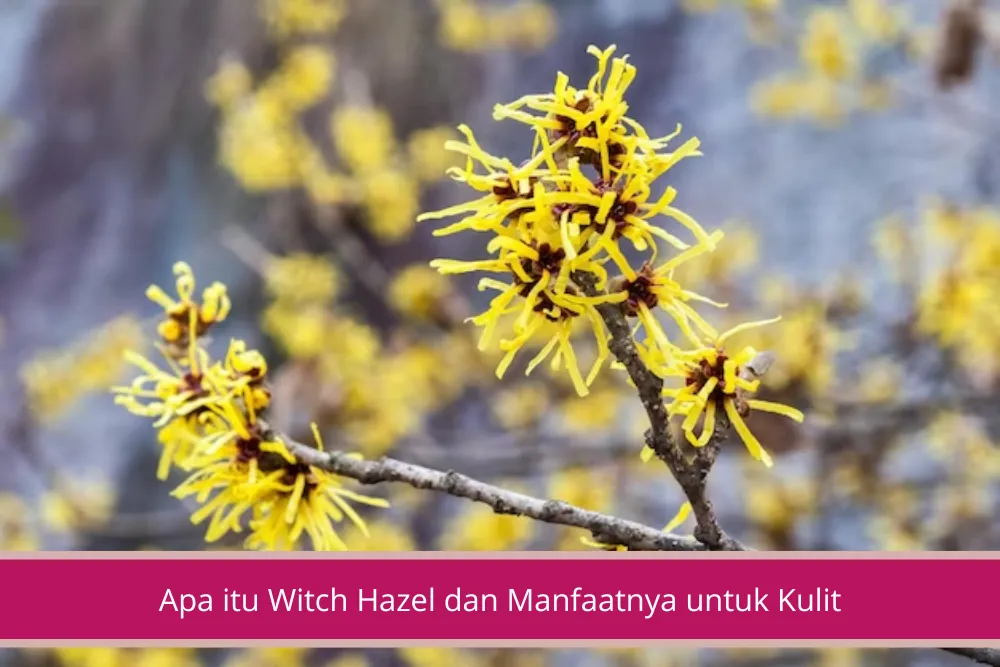 Gambar Apa itu Witch Hazel Ketahui Lebih Jauh Tentang Manfaat dan Lainnya Bestie