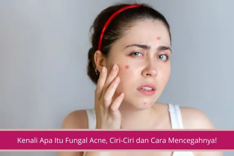 Gambar Kenali Apa Itu Fungal Acne Ciri Ciri dan Cara Mencegahnya